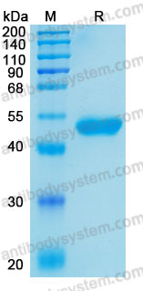 Recombinant Human CD5 Protein, C-His (Active)