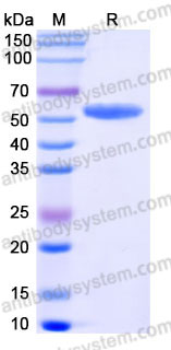 SDS-PAGE for Recombinant Human GLA Protein, C-His (Active) ?>
