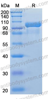 Recombinant Human C2/Complement C2 Protein, C-His (Active)