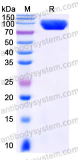 Recombinant Human CD115/CSF1R Protein, C-His (Active)
