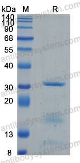 Recombinant Human PRSS2 Protein, C-10*His (Active)