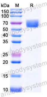 Recombinant Human CD98/SLC3A2 Protein, C-His (Active)