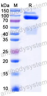 Recombinant Human MET/c-Met/HGFR Protein, C-His (Active)