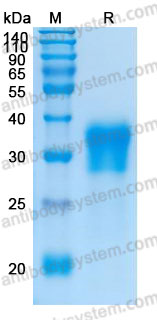 Recombinant Human CD16a/FCGR3A (F176) Protein, C-His (Active)