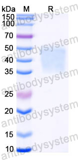 Recombinant Human CD16a/FCGR3A (F176) Protein, C-His (Active)