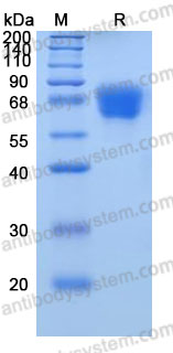 Recombinant Human SERPINF2/α2-antiplasmin Protein, C-10*His (Active)