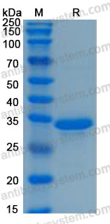 Recombinant Human IGFBP1 Protein, C-His (Active)
