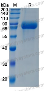 Recombinant Human IL6 & IL6RA Protein, C-His (Active)