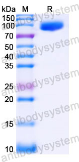 Recombinant Human CD126/IL6R/IL-6RA Protein, C-Fc (Active)