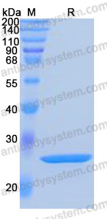 Recombinant Human HMGB1 Protein, C-His (Active)