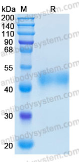 Recombinant Human CSF1/M-CSF Protein, C-His (Active)