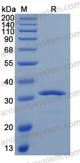 Recombinant Human CSH1 Protein, C-His (Active)