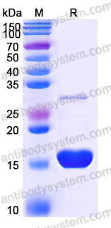 Recombinant Human TXN Protein, N-His (Active)