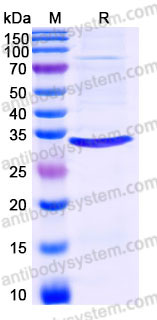 Recombinant Human CD20/MS4A1 Protein, C-Flag (Active)