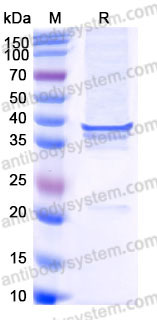 Recombinant Human CD20/MS4A1 Protein, C-His-Flag (Active)