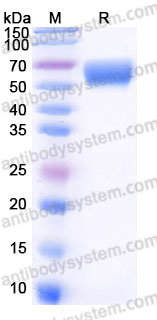 Recombinant Human CD64/FCGR1A Protein, C-His (Active)