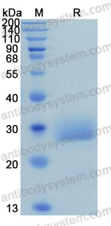 Recombinant Human CD32A/FCGR2A (R167) Protein, C-His (Active)