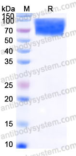 Recombinant Human CD107b/LAMP2 Protein, C-His (Active)