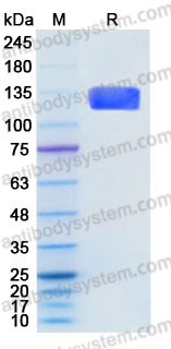 Recombinant Human CD56/NCAM1 Protein, C-Fc (Active)
