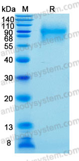 Recombinant Human CD66a/CEACAM1 Protein, C-His (Active)