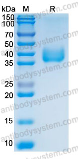 Recombinant Human CD142/F3/TF Protein, C-His (Active)