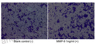 Recombinant Human MMP9 Protein, C-His (Active)