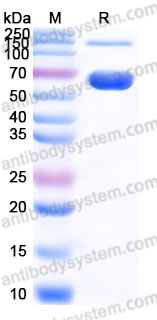 Recombinant Human CD122/IL2RB Protein, C-Fc (Active)