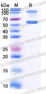 Recombinant Human IL2RB & IL2RA & IL2RG Protein, C-Fc-Hole & C-Fc-Knob (Active)
