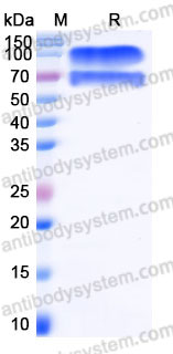 SDS PAGE for Recombinant Human IL2RB & IL2RG Heterodimer, C-Fc & C-Fc (Active) ?>