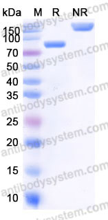 Recombinant Human CD19 Protein, C-Fc (Active)