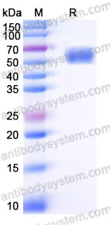 Recombinant Human CD19 Protein, Tag free (Active)