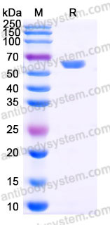 Recombinant Human CD116/CSF2RA Protein, C-His (Active)