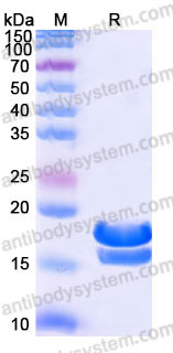 Recombinant Human VEGF121 Protein, C-His (Active)