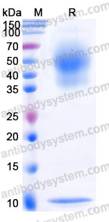 Recombinant Human CD227/MUC1 Protein, C-His (Active)