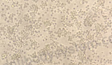 Recombinant Human CD31/PECAM1 Protein, C-His (Active)
