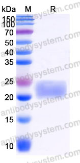 Recombinant Human CD152/CTLA4 Protein, C-His (Active)