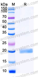 Recombinant Human CD152/CTLA4 Protein, C-Flag (Active)