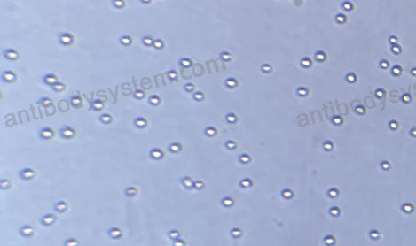 Recombinant Human CD326/EPCAM Protein, C-His (Active)