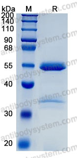 Recombinant Human CPE Protein, C-His (Active)