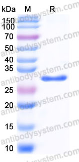 Recombinant Human LGALS3/Galectin-3 Protein, Tag free (Active)