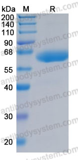 Recombinant Human LBP Protein, C-His (Active)