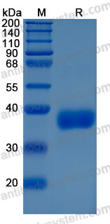 Recombinant Human AZU1/CAP37/HBP Protein, C-10*His (Active)