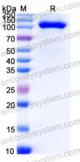 Biotinylated Human CD22/Siglec-2 Protein, C-His-Avi