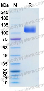 Recombinant Human CD22/Siglec-2 Protein, C-His (Active)