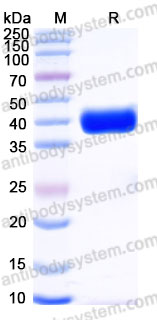 Recombinant Human CD120b/TNFRSF1B/TNFR2 Protein, C-His (Active)