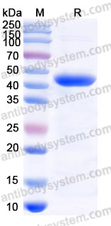 Recombinant Human CD88/C5AR1 Protein, C-Fc (Active)