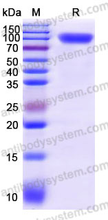 Recombinant Human ERBB3/HER3 Protein, C-His (Active)
