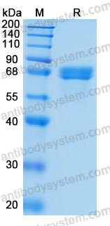 Recombinant Human ACHE Protein, C-His (Active)