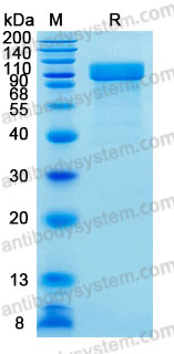 Recombinant Human IDS/Idursulfase Protein, C-10*His (Active)
