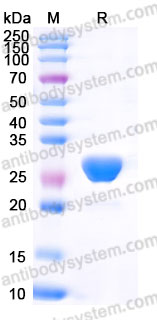 Recombinant Human CD252/TNFSF4/OX40L Protein, N-His (Active)
